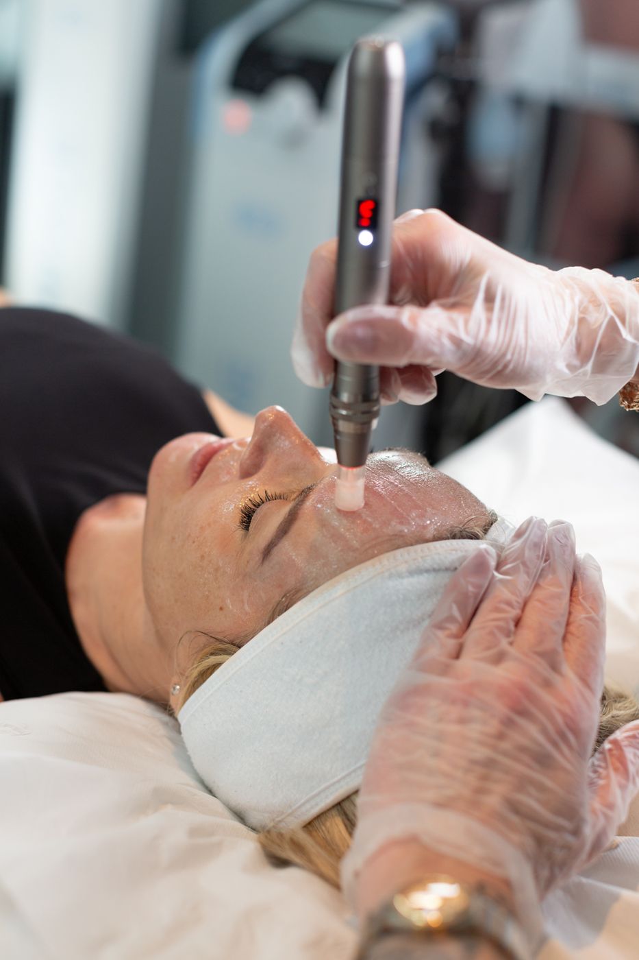 Plasma pen at Idunn Rejuvenation